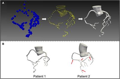 Hemodynamic Characteristics of Patients With Suspected Coronary Heart Disease at Their Initial Visit